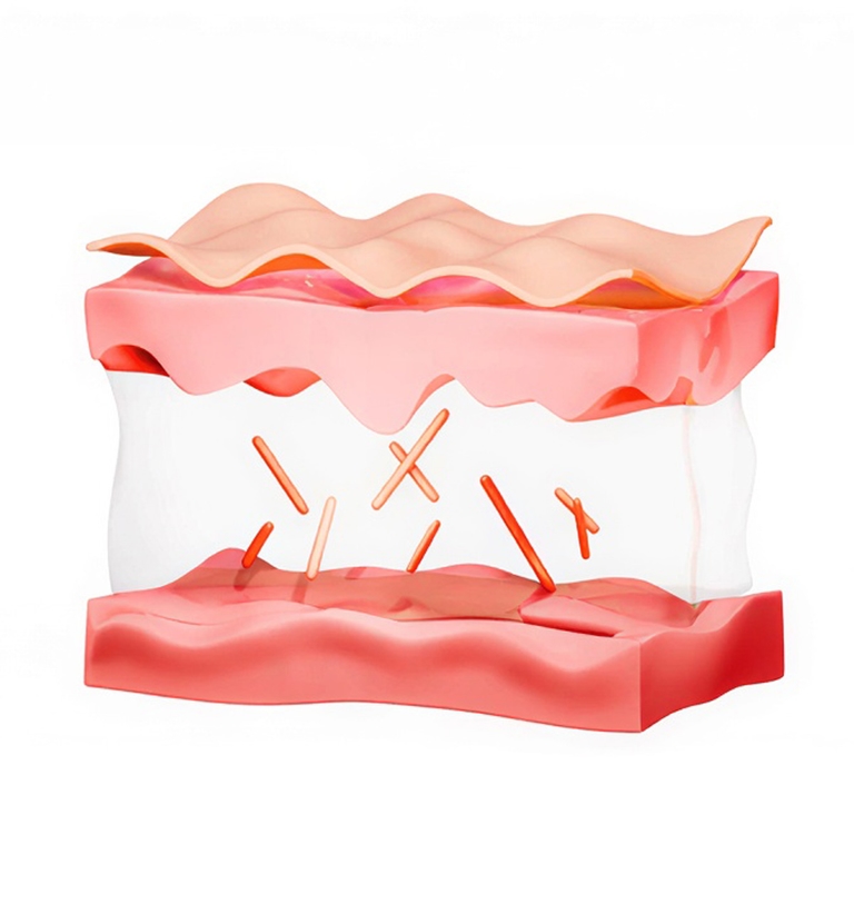 STEP 1. 진피 균형의 붕괴