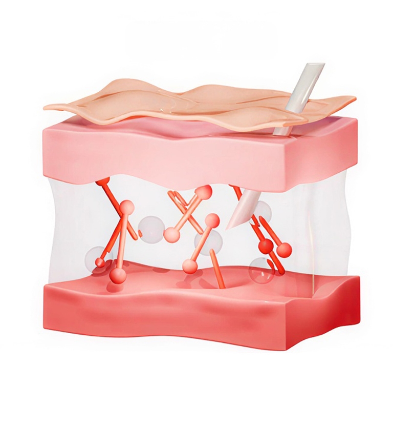 STEP 2. 고순도 콜라겐 주입